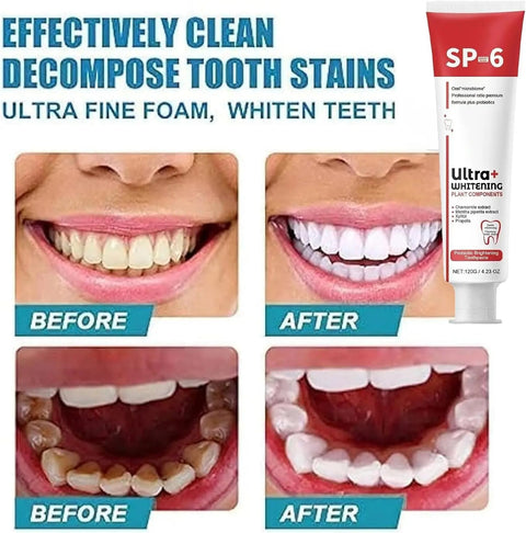 “Fresh Breath. Clean Feel. White Teeth. That’s SP-6 Ultra+.”1 Pcs 34.99 AED (Free Delivery)